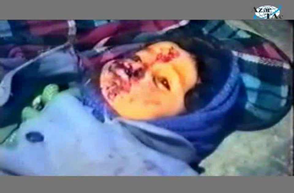 It has been 20 years since Khojaly genocide
