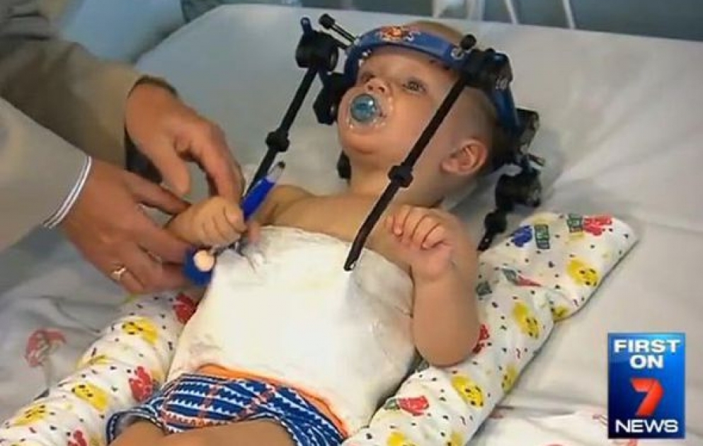 Doctors Reattach Toddler's Decapitated Head After Horrific Car Crash- Young Jackson Taylor