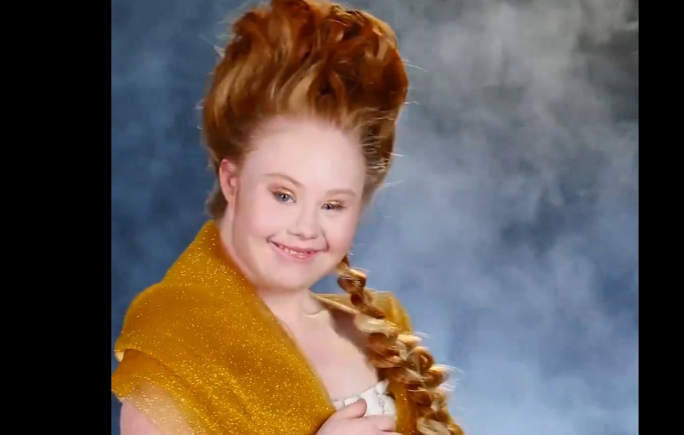 Down syndrome is not a disease