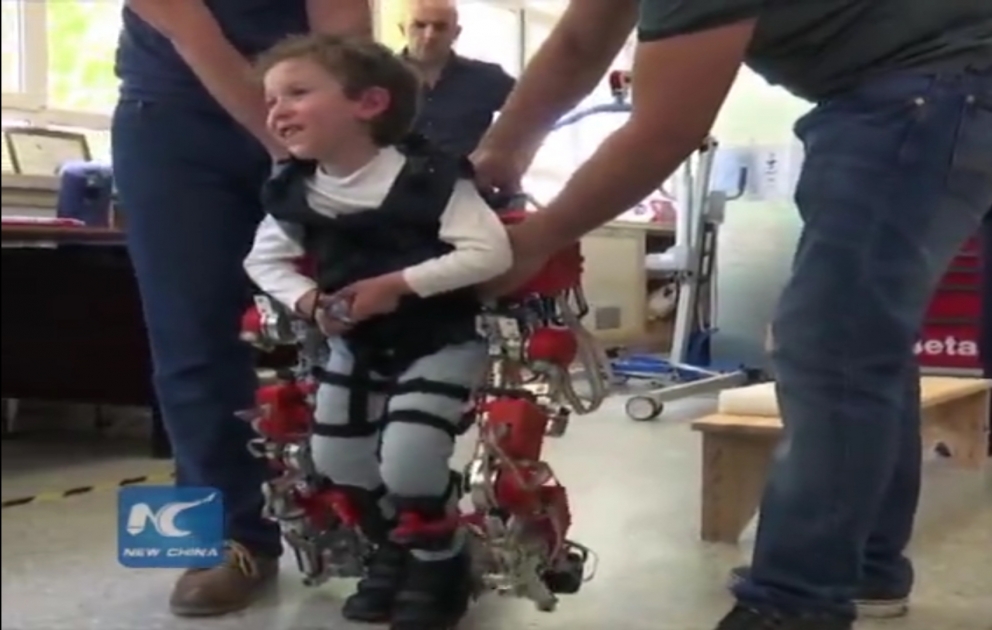 Uşaqlarda onurğa xəstəliyini müalicə edən  ROBOT