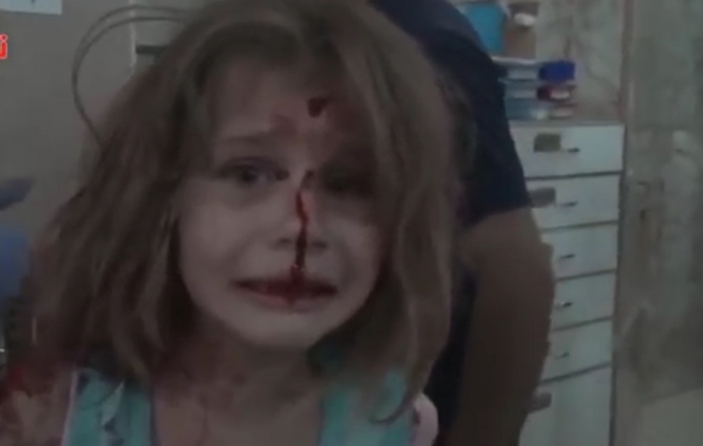 Видео с раненой сирийской девочкой потрясло мир