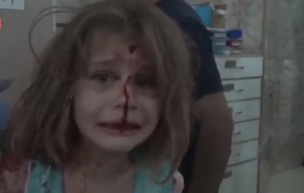 Dünyanı sarsıdan yaralı suriyalı qızın videosu