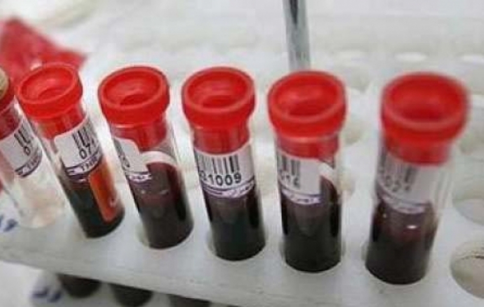 В Азербайджане в ходе обязательного медобследования выявлены 440 носителей талассемии