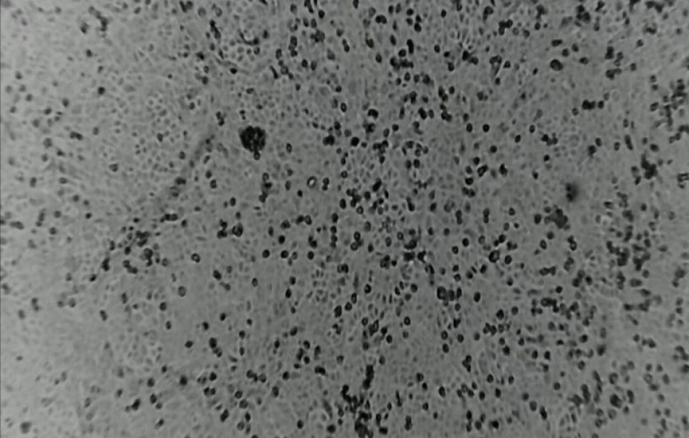 Video zeigt Coronavirus im Zeitraffer