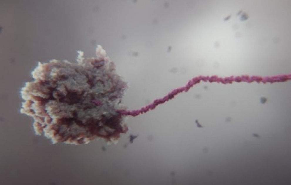 Racing for a cure: is the world getting closer to a COVID19 vaccine?