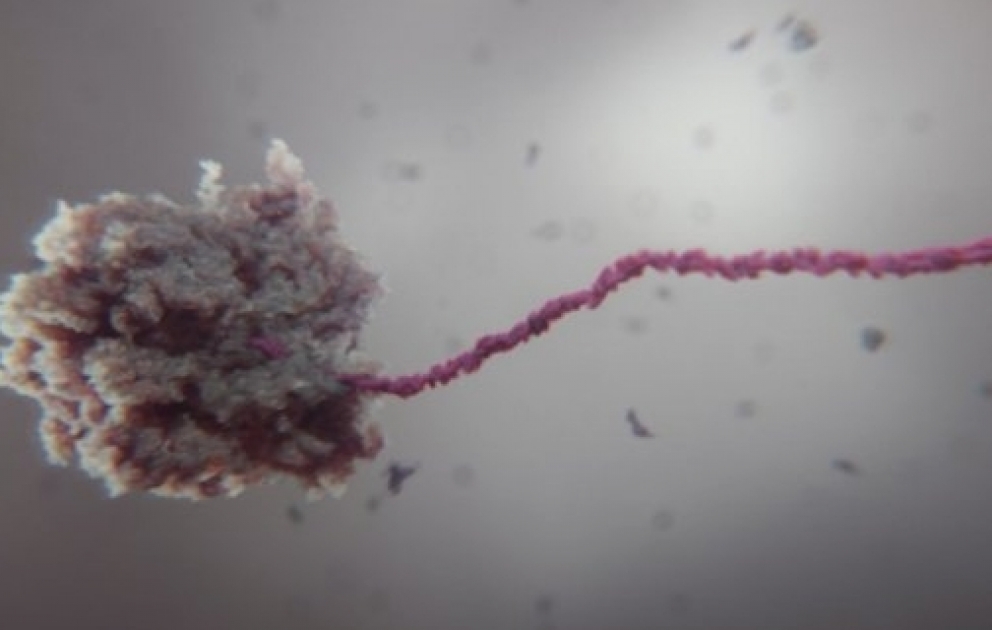 Coronavirus : la course pour trouver un vaccin est lancée UnreportedEurope