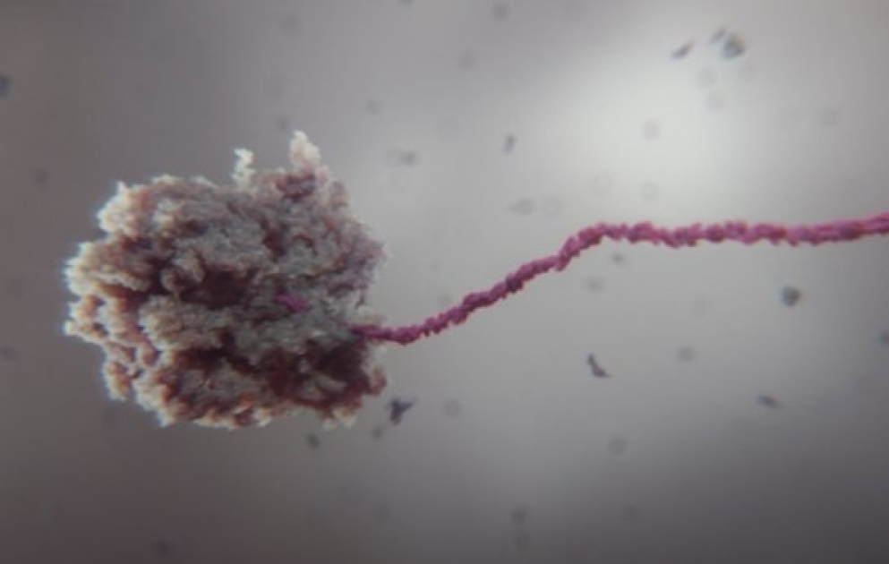 Dringend gesucht: Impstoff gegen SARSCoV2, vielversprechend: RNA-Impfstoffe, die das Virus von innen manipulieren UnreportedEurope