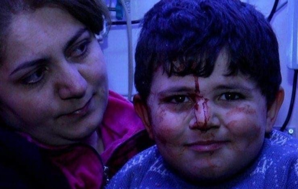 Erməni terrorunun canlı şahidi 6 yaşlı Bəxtiyar: Evimizə bomba düşəndə qorxmadım, heç kişi də qorxar?
