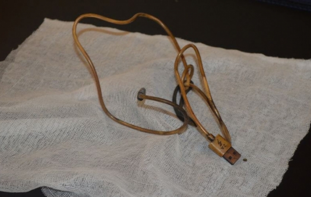 Türkiyədə həkimlər 15 yaşlı uşağın mədəsindən 1 metrlik kabel çıxarıblar